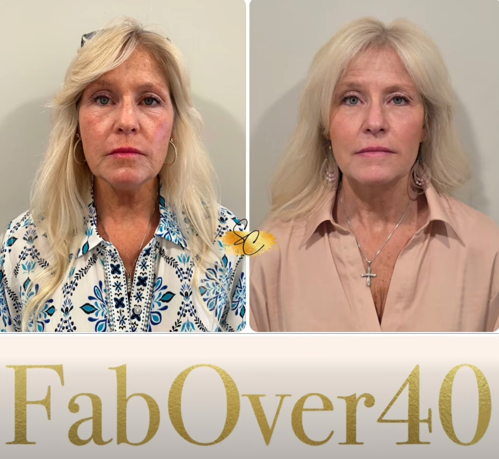 She’s A Quarter Finalist! VOTE VOTE VOTE!